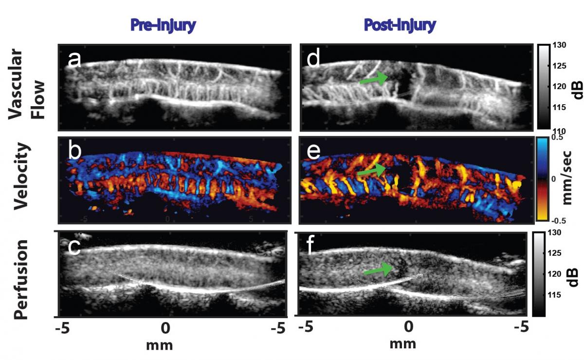 Increasing blood flow to the spinal cord Center for Neurotechnology